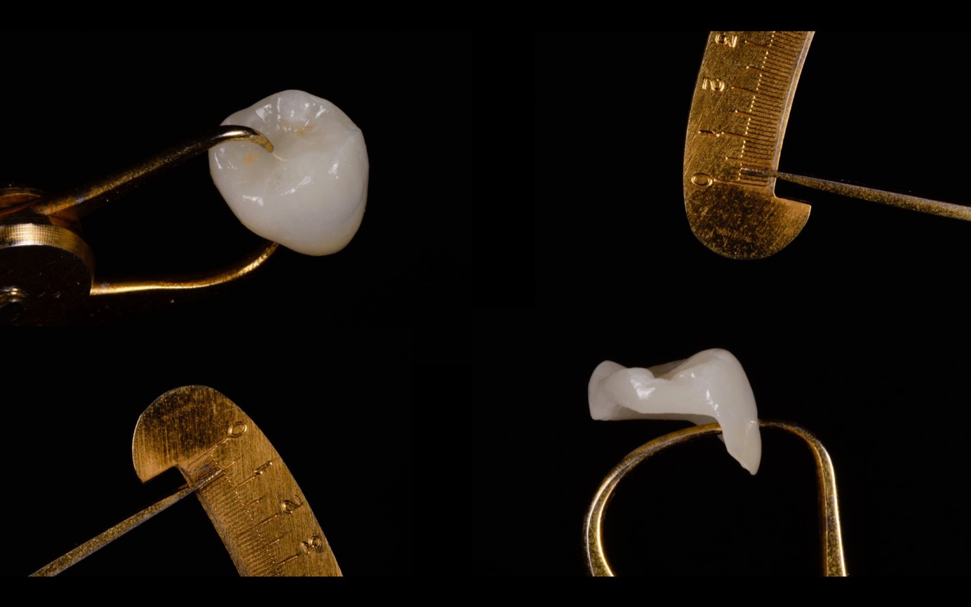 Daily aesthetic dentistry The contribution of the spectrophotometer