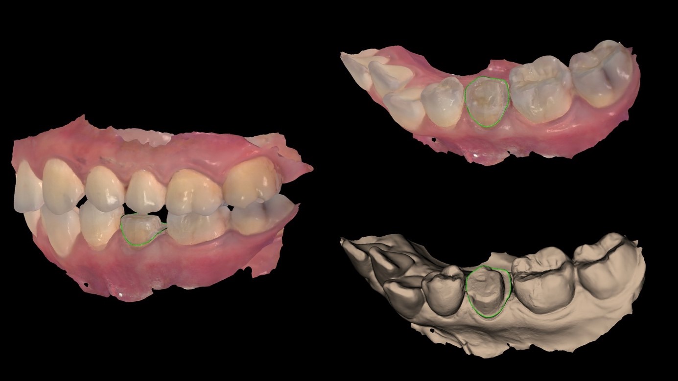 Daily aesthetic dentistry The contribution of the spectrophotometer