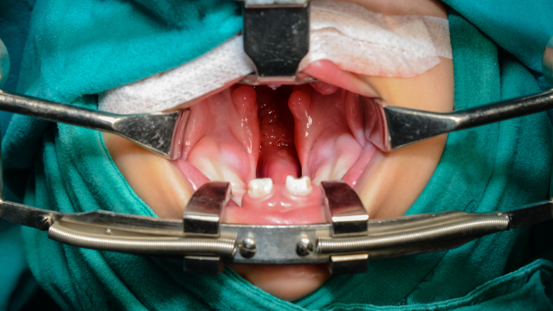 USC researchers seek to understand craniofacial abnormalities