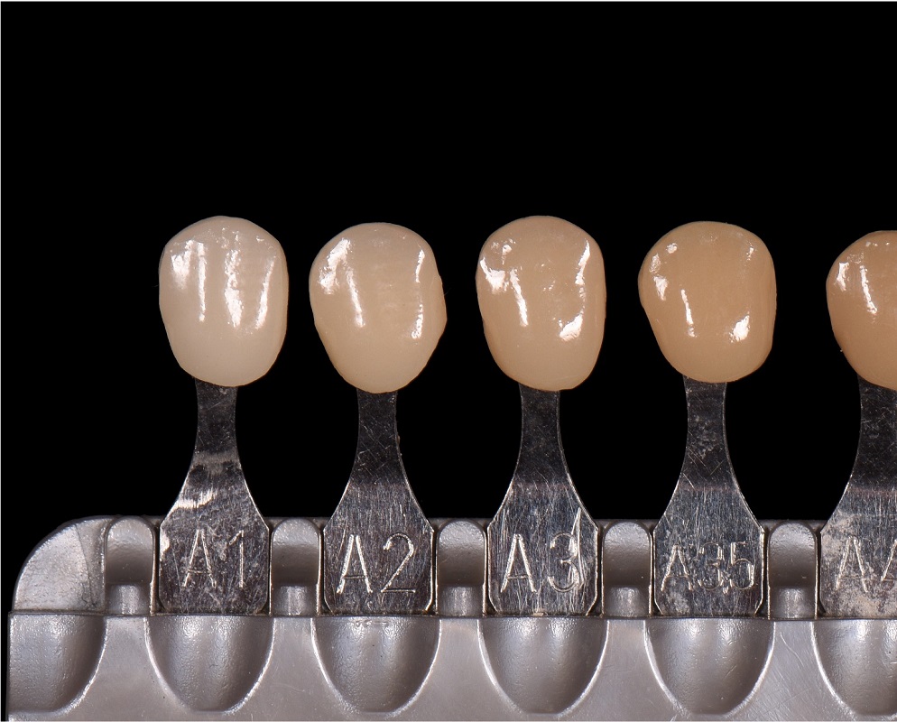 Digital dental shade measurement