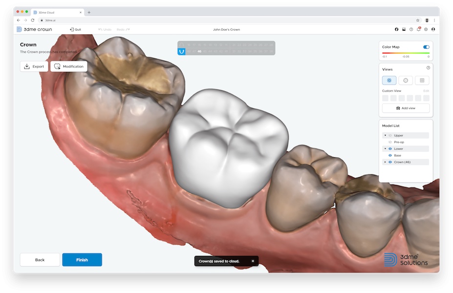 Since 3Dme Crown connects to the 3Dme Cloud data management platform, users can access it immediately online without having to install a program. (Image: Imagoworks)