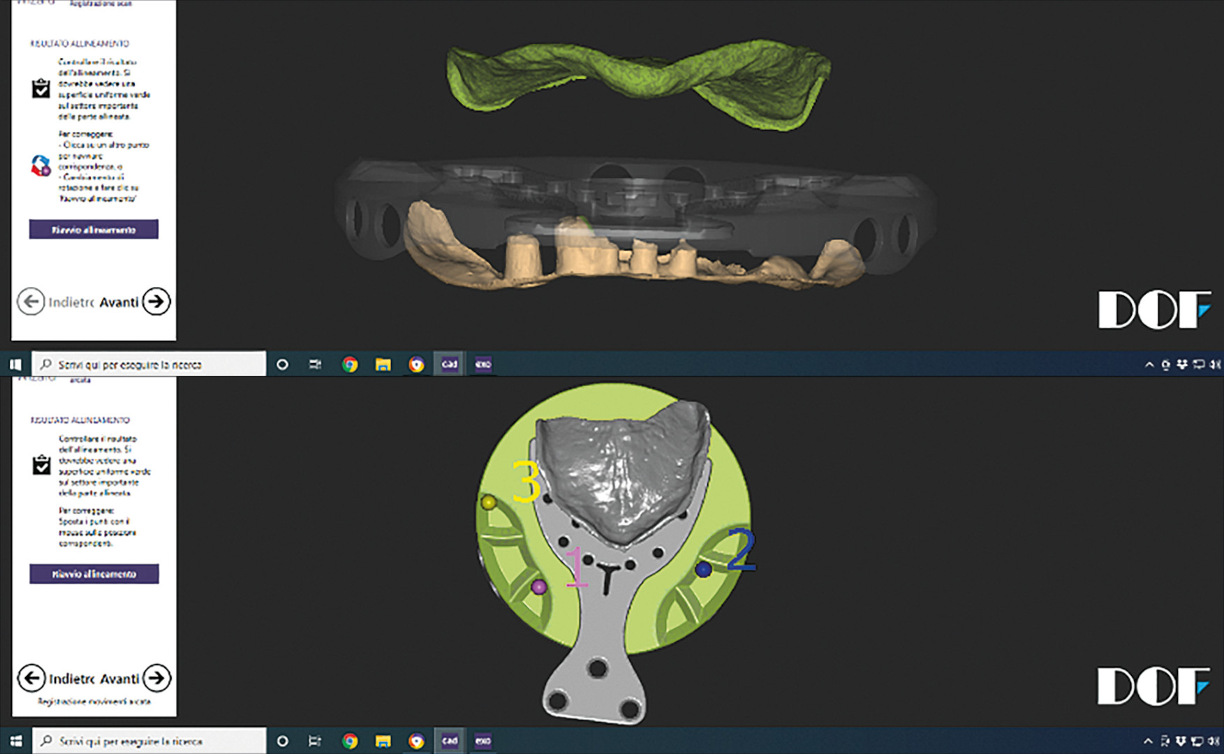 Production of complete maxillary and mandibular dentures using CAD/CAM ...