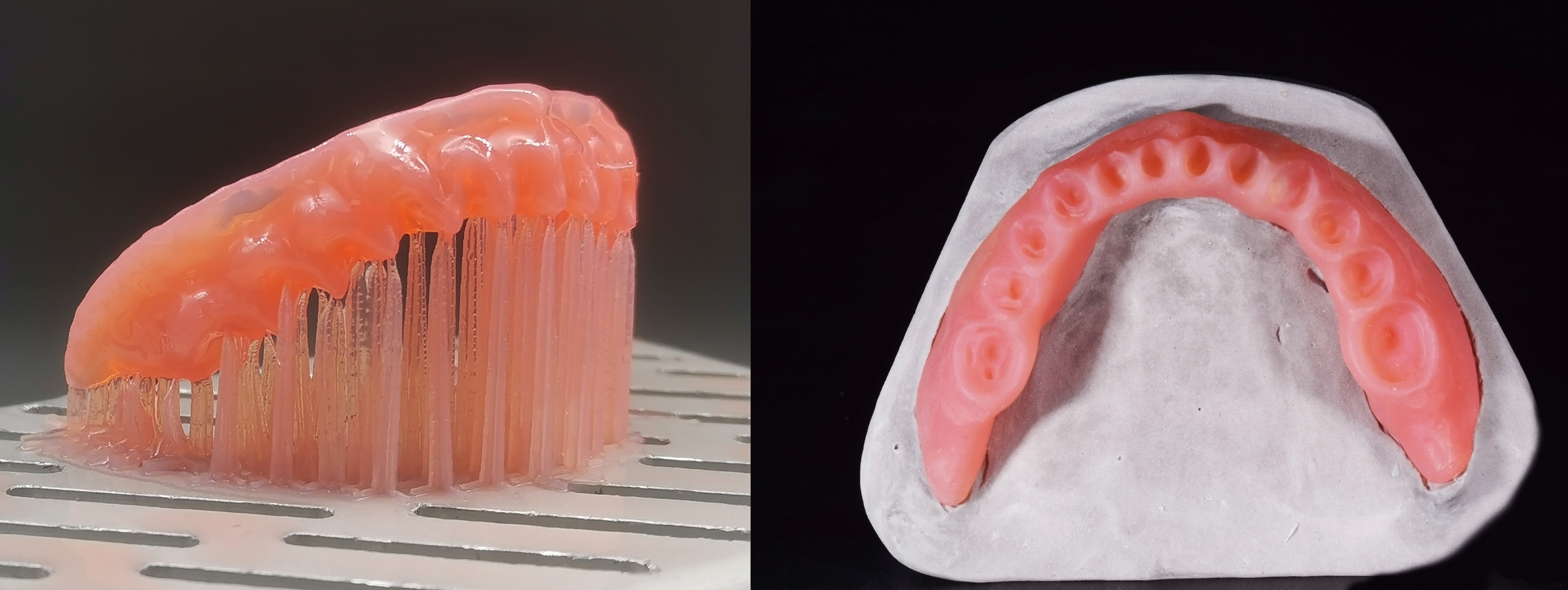 Production of complete maxillary and mandibular dentures using CAD/CAM ...