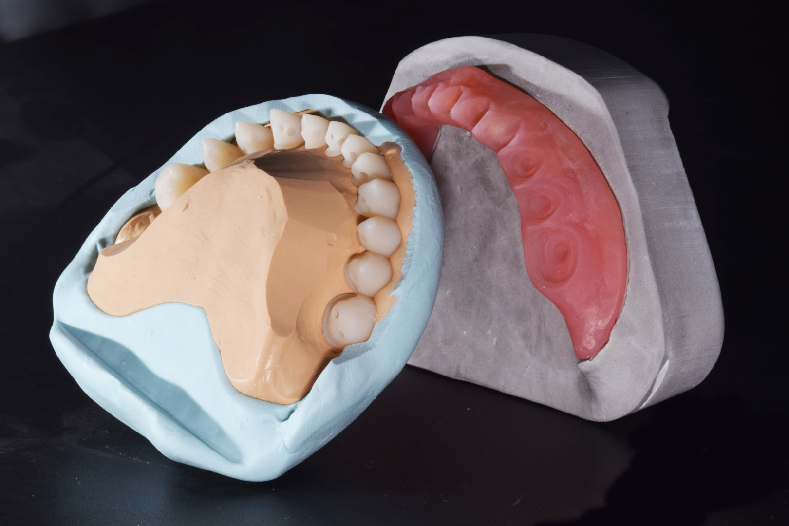 Production of complete maxillary and mandibular dentures using CAD/CAM ...
