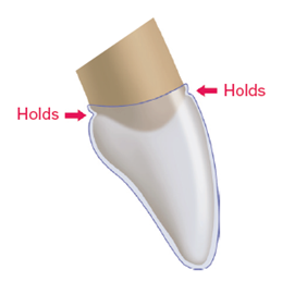 Fig. 2: Grip of Henry Schein Orthodontics aligners on teeth.