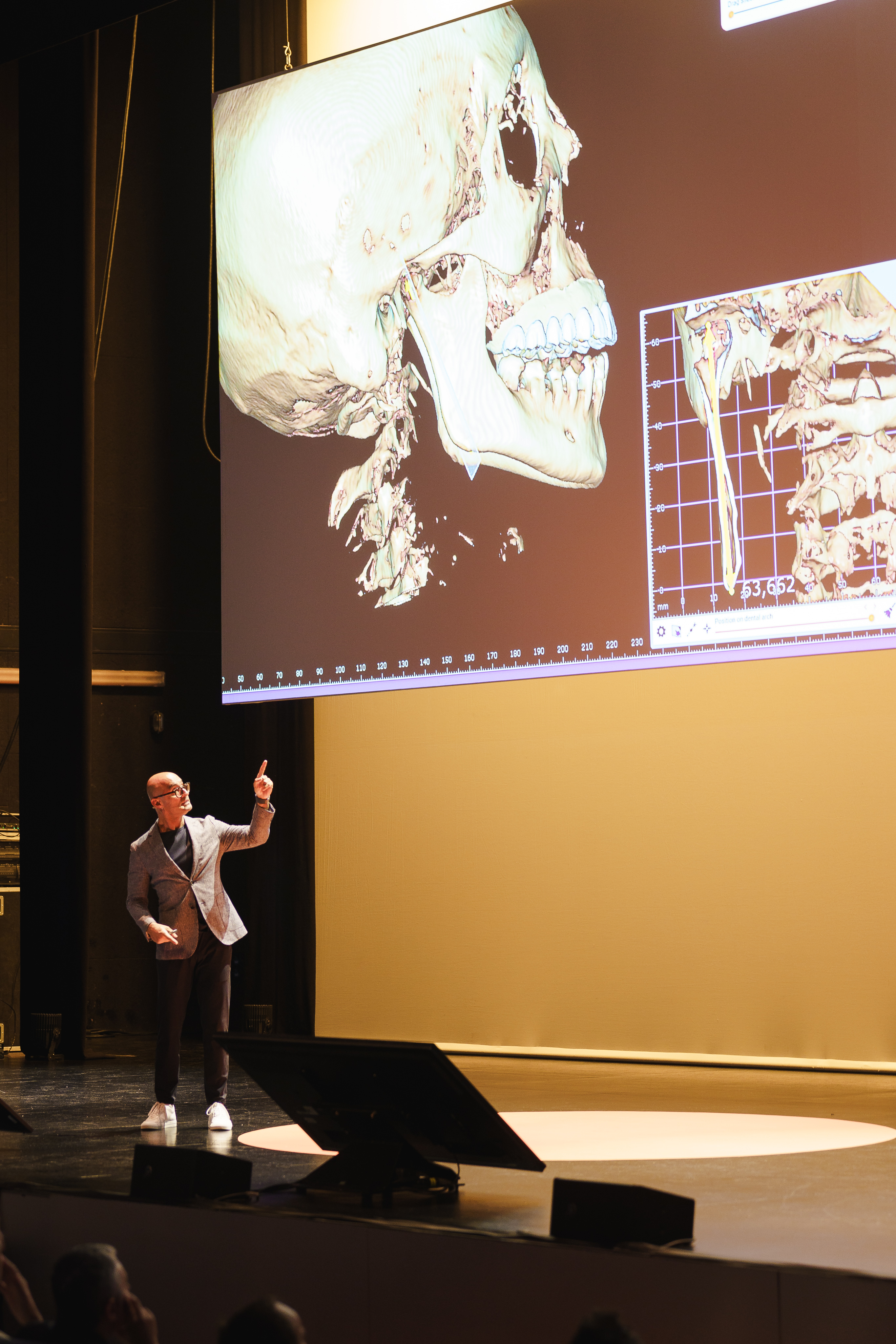 Edris Rasta Yes, we CAD!—exocad Insights 2024